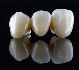 a porcelain dental bridge