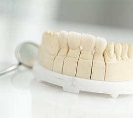 Model smile with dental crown restoration