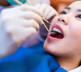 A woman having a dental checkup in Fargo