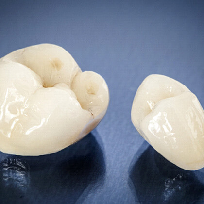 ceramic dental crowns on blue background