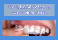 Person placing an Invisalign tray in mouth with text saying the clear way to your ideal smile