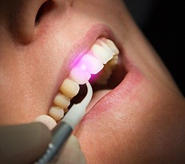 Closeup of patient receiving laser dental treatment
