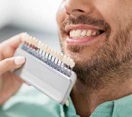 Man's smile compared with tooth color chart