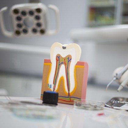 Model of the inside of the tooth
