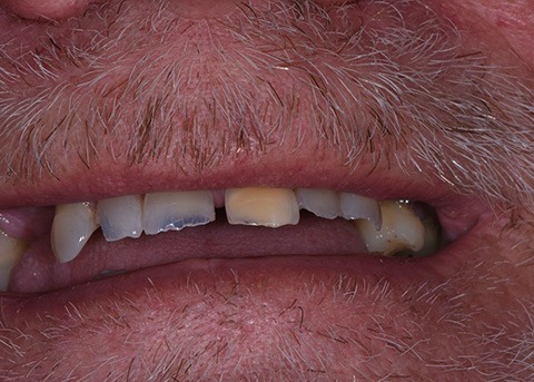 smile before