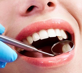 Closeup of smile during dental exam